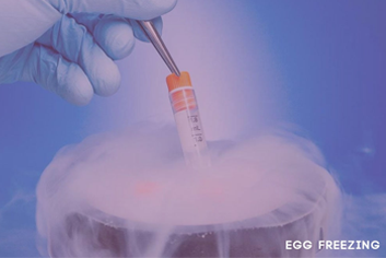 Egg Freezing