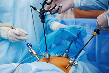 Laparoscopic surgery